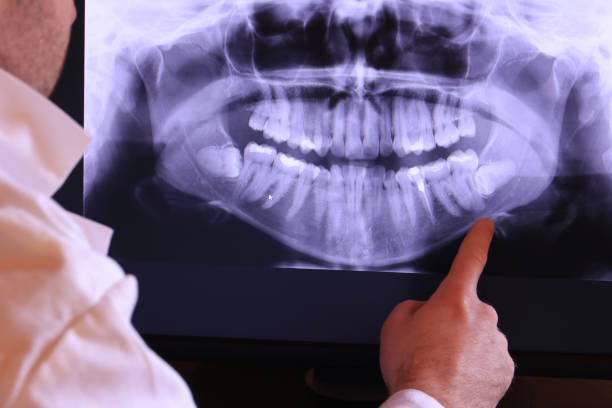 Best Urgent Dental Care for Toothache in Lucerne, CA